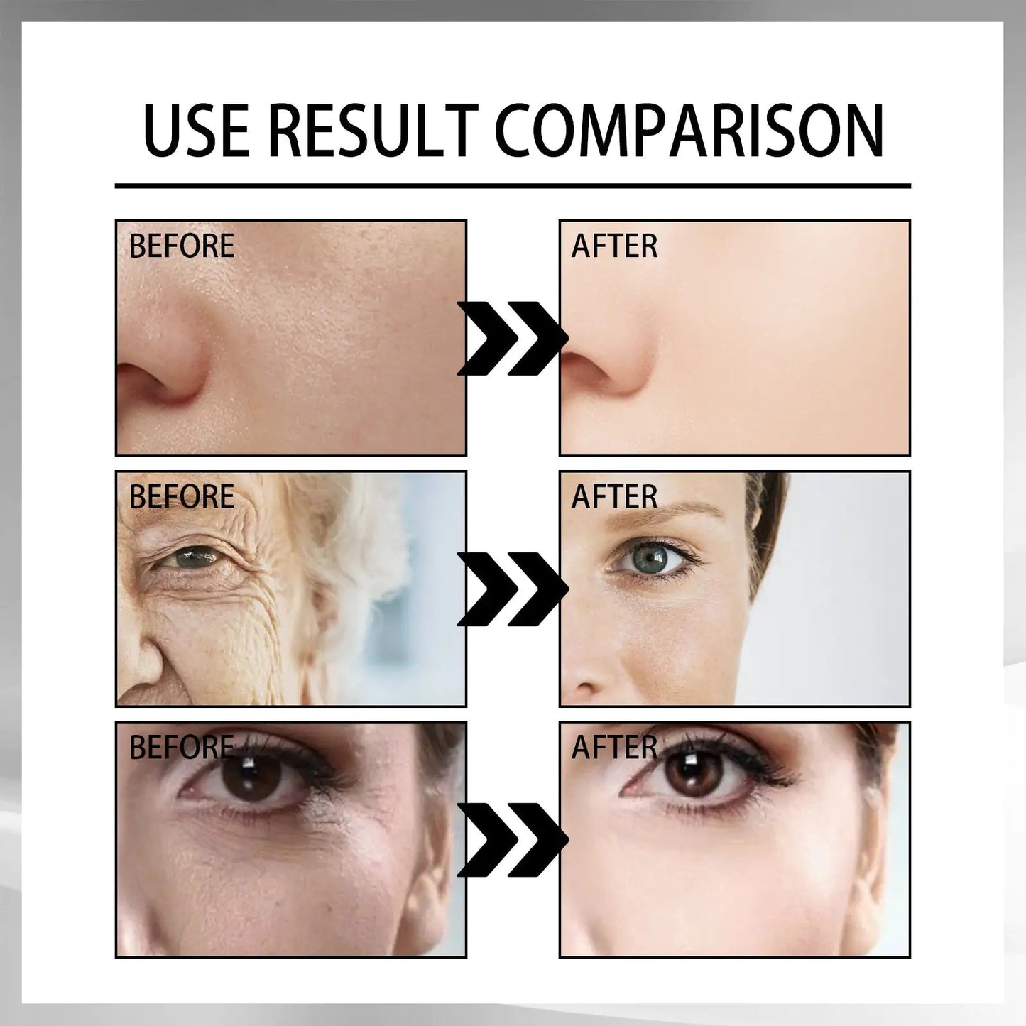 Snail Cream Fading Wrinkle French Lines Replenishment Firming Skin Anti-Aging WEM Support (www.WEM.support)