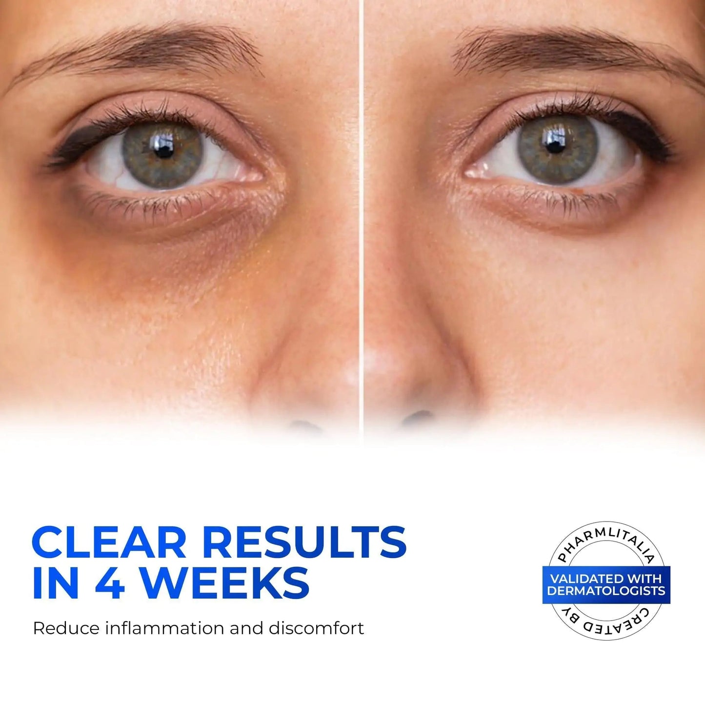 Retinol Eye Cream for Puffiness and Bags Under Eyes Hyaluronic Acid Peptide WEM Support (www.WEM.support)