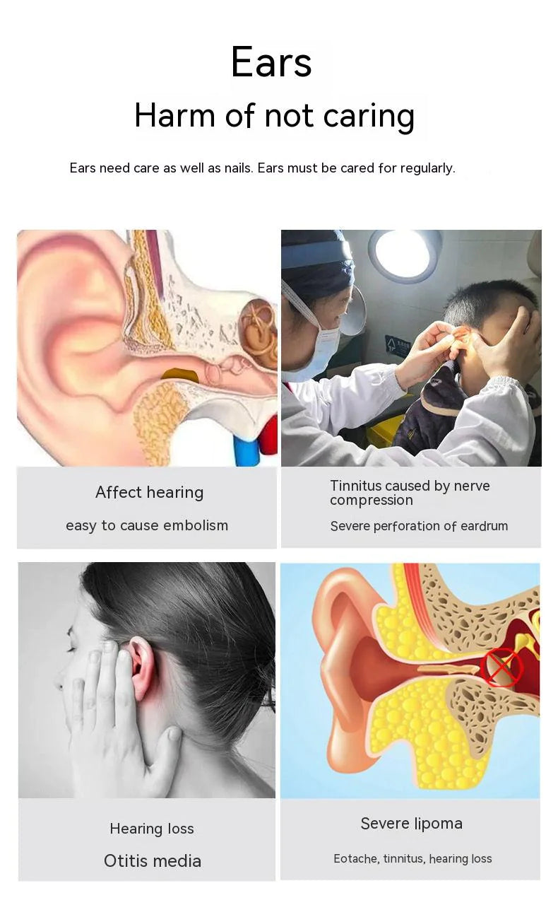 Wireless Smart HD Ear Endoscope WEM Support (www.WEM.support)