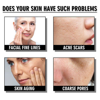 Snail Cream Fading Wrinkle French Lines Replenishment Firming Skin Anti-Aging WEM Support (www.WEM.support)