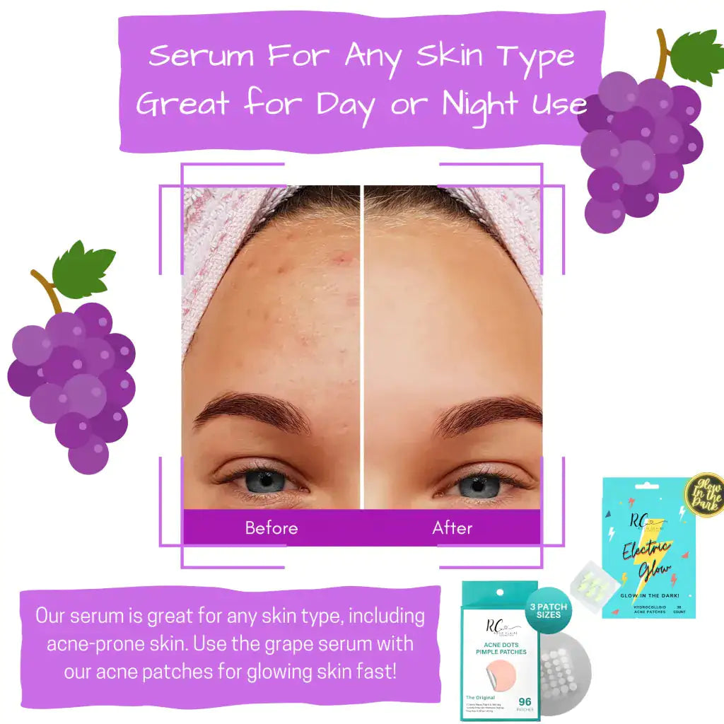 Hyaluronic Acid Vitamin C Antioxidant Serum WEM Support (www.WEM.support)