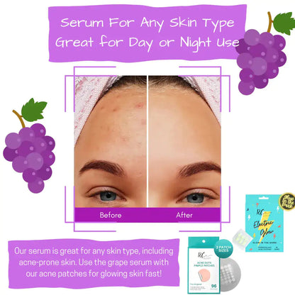 Hyaluronic Acid Vitamin C Antioxidant Serum WEM Support (www.WEM.support)