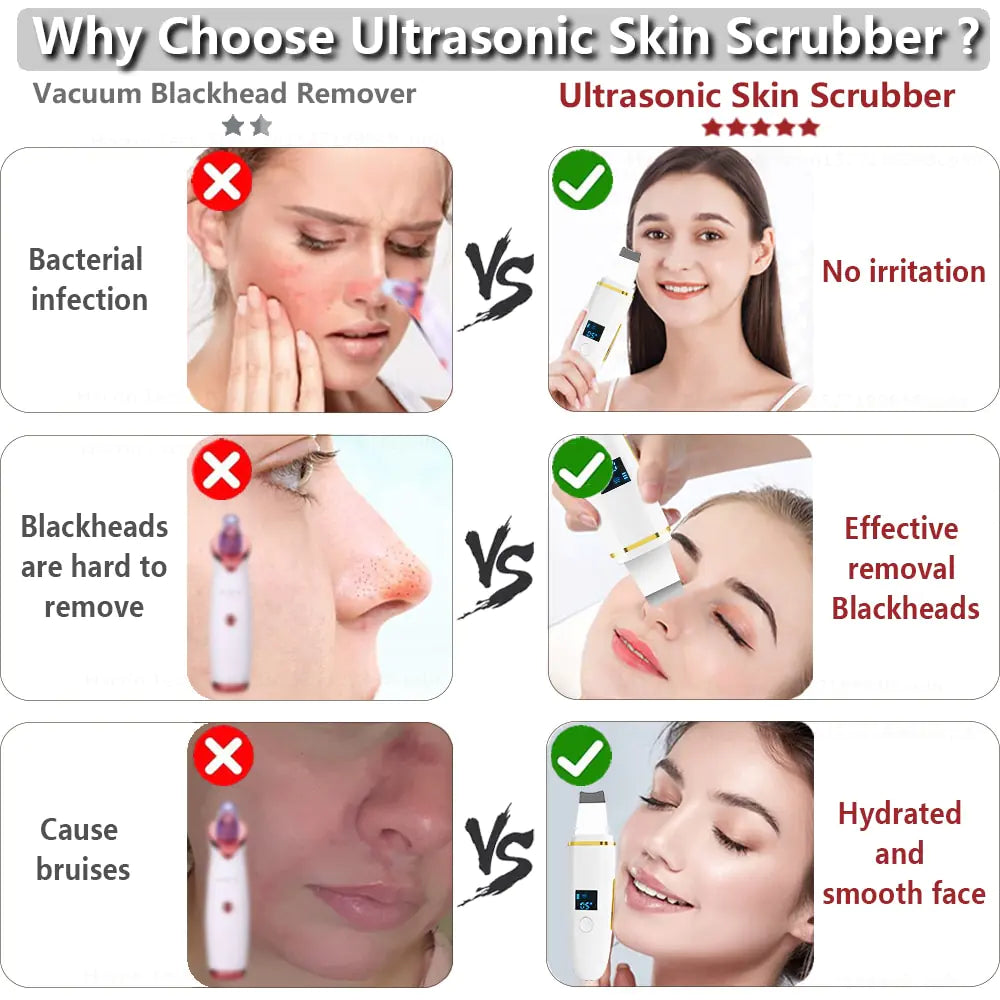 Ultrasonic Skin Scrubber: Facial Cleansing WEM Support (www.WEM.support)
