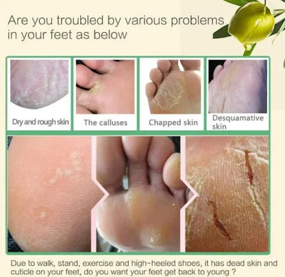 AloeGlow Foot Mask - Catch Cards