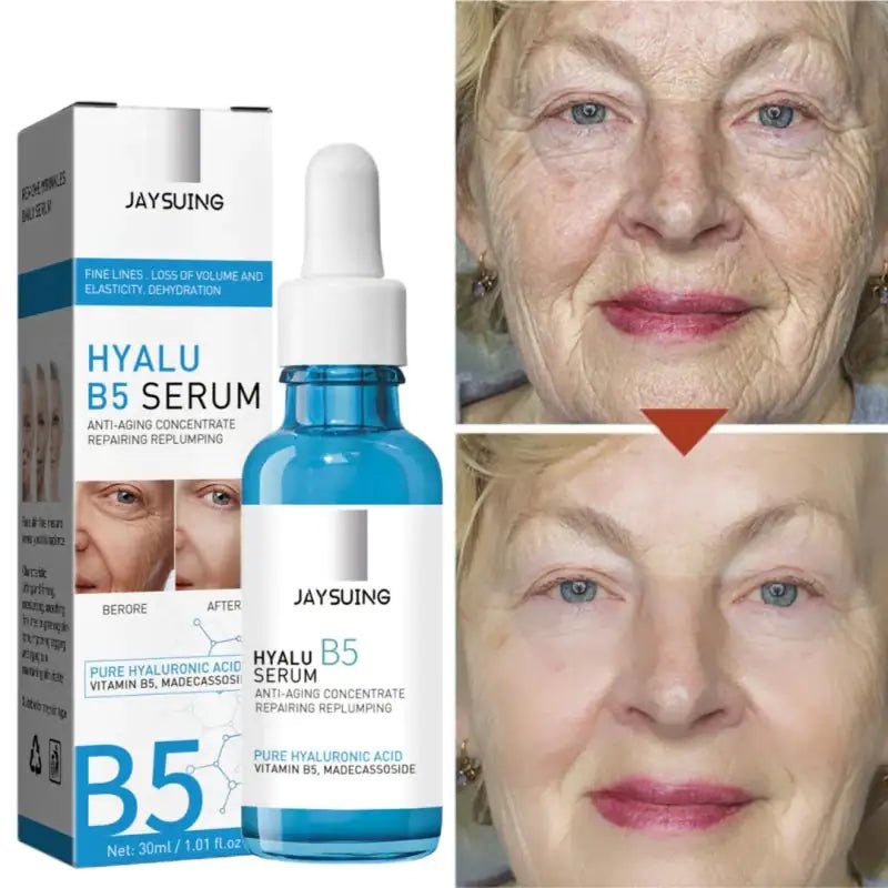 B5 Hyaluronic Acid Serum - Catch Cards