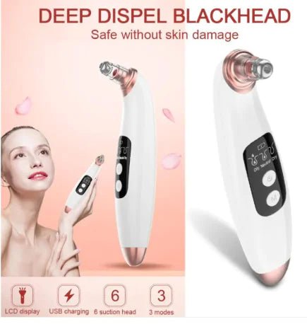 ClearSuction Pro - Catch Cards