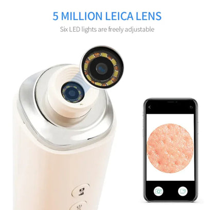 HD Wireless Pore Cleaner WEM Support (www.WEM.support)