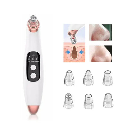 Blackhead Remover Pore Vacuum WEM Support (www.WEM.support)