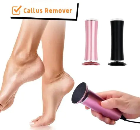 Electric Foot Callus Remover WEM Support (www.WEM.support)