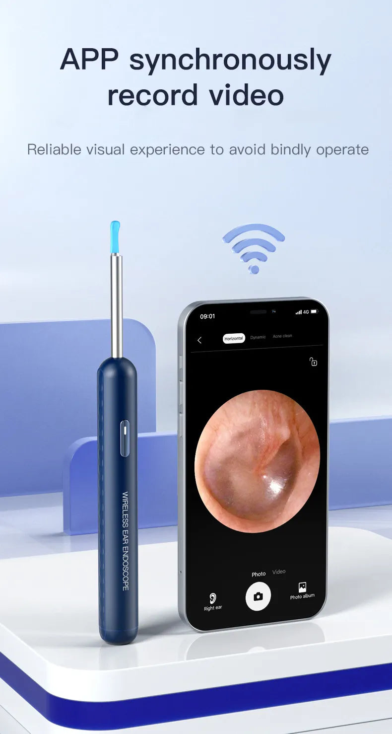 Dispositivo Endoscópio de Limpeza de Ouvido Visual HejK.com