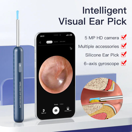 Visual Earpick Endoscope Smart Ear Picking Tools WiFi WEM Support (www.WEM.support)