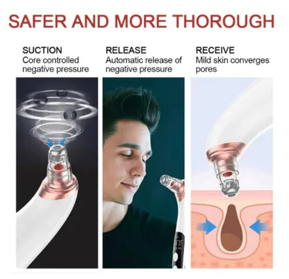 ClearSuction Pro