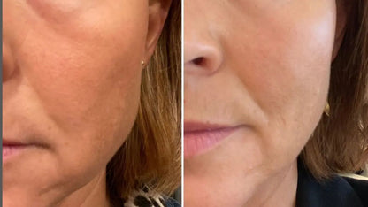 Anti-Aging HIFU, EMS and Microcurrent WEM Support (www.WEM.support)