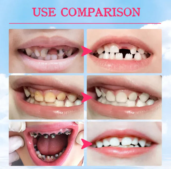 Kids’ Foam Tooth Mousse WEM Support (www.WEM.support)