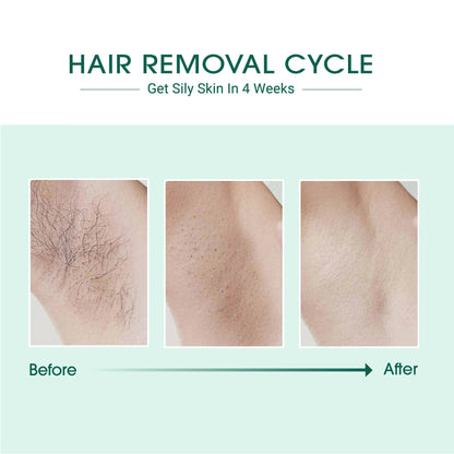 Laser IPL Hair Removal WEM Support (www.WEM.support)
