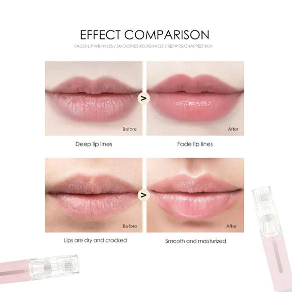 3-in-1 Lip and Beard Care Roller WEM Support (www.WEM.support)