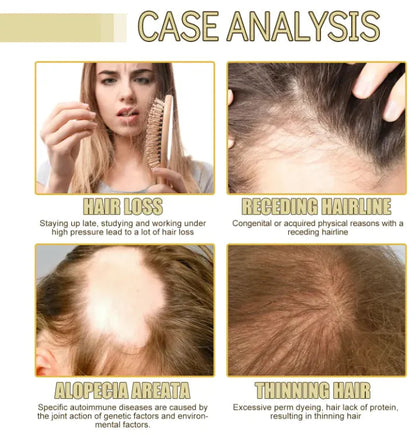 Rosemary Dense Hair Essential Oil WEM Support (www.WEM.support)