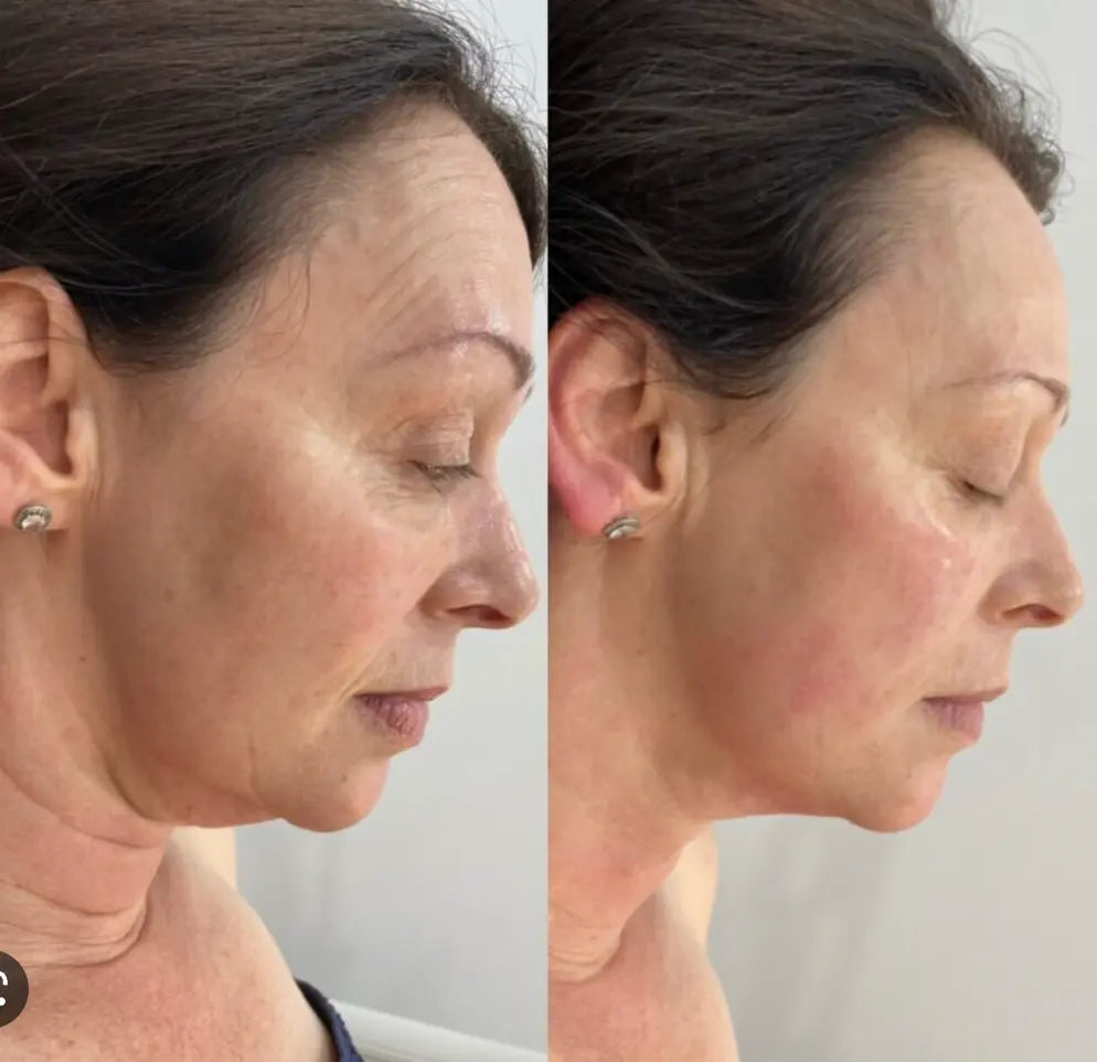 Anti-Aging HIFU, EMS and Microcurrent WEM Support (www.WEM.support)