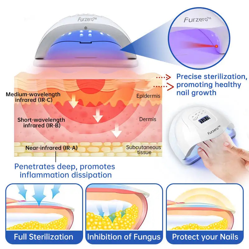 Fungus Laser Therapy Device WEM Support (www.WEM.support)