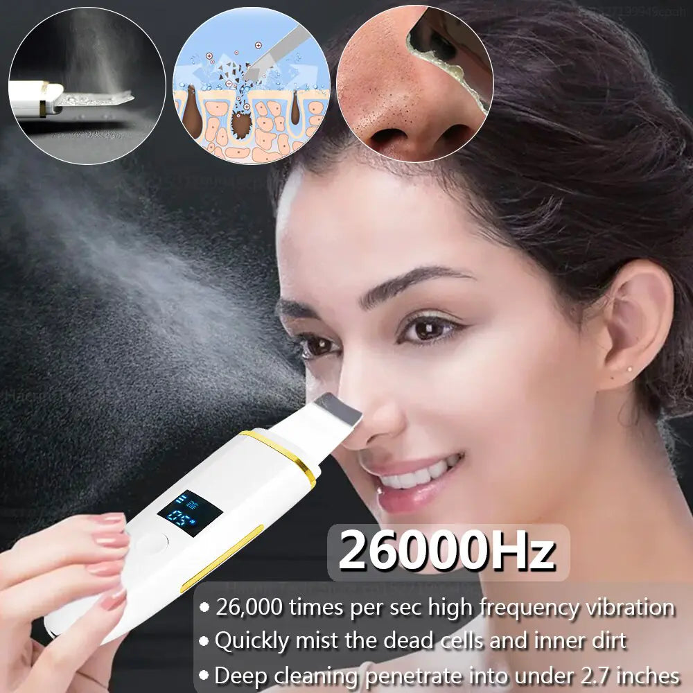 Ultrasonic Skin Scrubber: Facial Cleansing WEM Support (www.WEM.support)